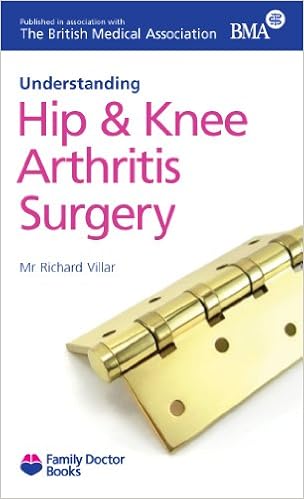 Understanding Hip and Knee Arthritis Surgery (Family Doctor Series)